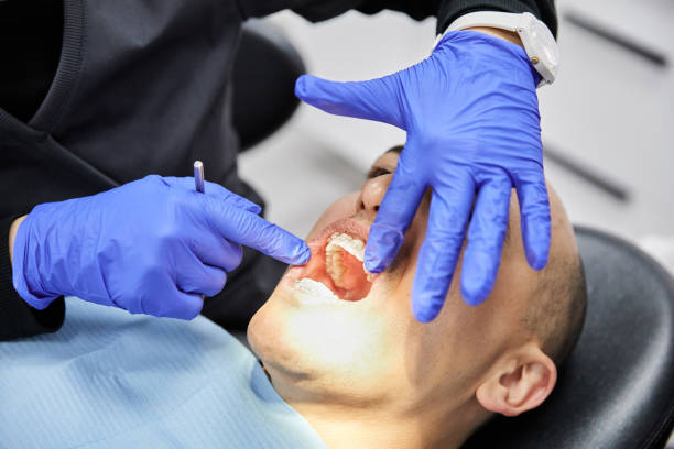 Best Chipped Tooth Repair Near Me  in West Valley City, UT